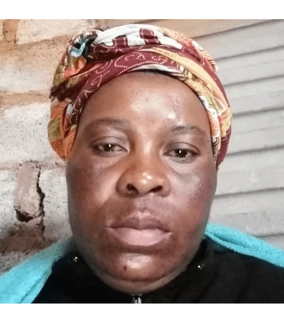 Blemishes / dark marks