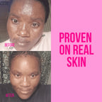 Blemish & Dark Spot Correcting Set - Face