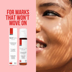 SpotFade Serum 50ml