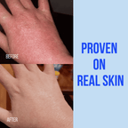 Before and after skin results showing Basix Skin Repair Cream proof