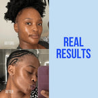 Customer before and after results for Basix Skin Repair Cream