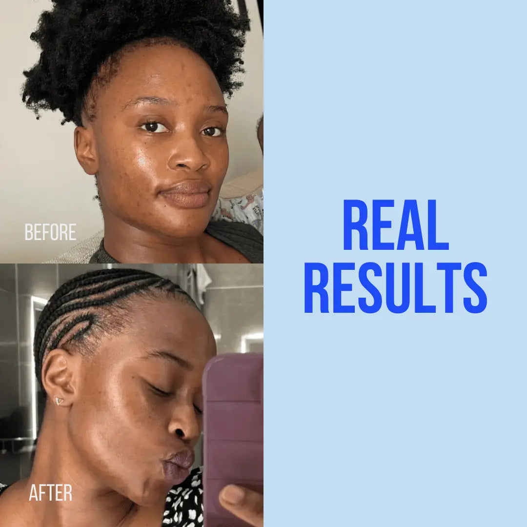 Customer before and after results for Basix Skin Repair Cream